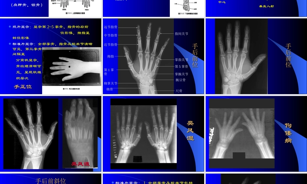四肢骨摄影技术.ppt