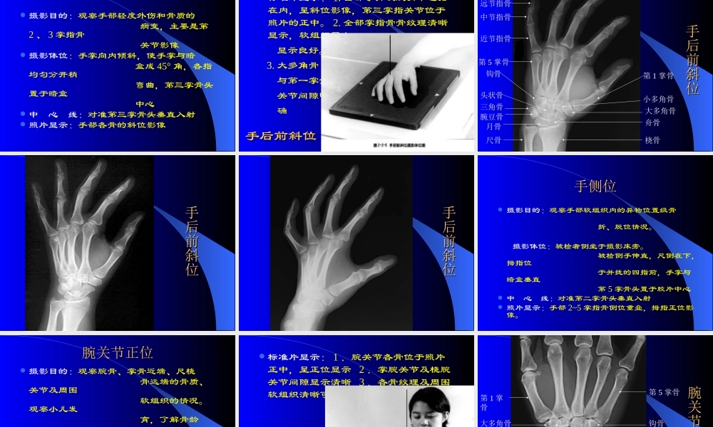 四肢骨摄影技术.ppt