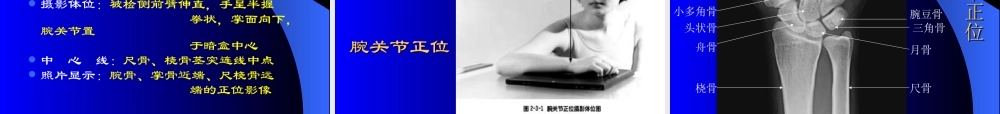 四肢骨摄影技术.ppt