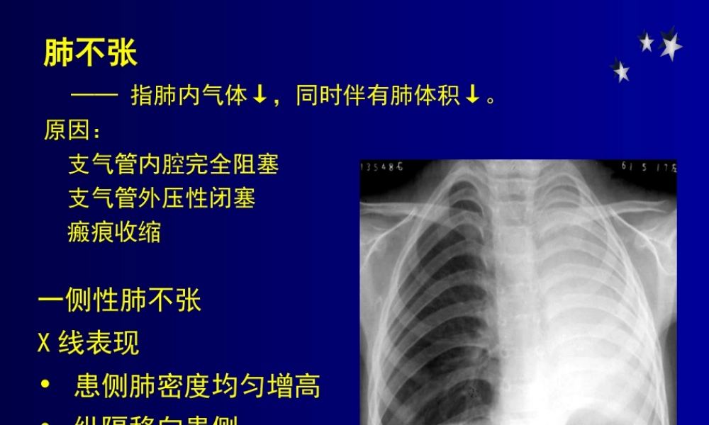 影像学-呼吸基础病变.ppt