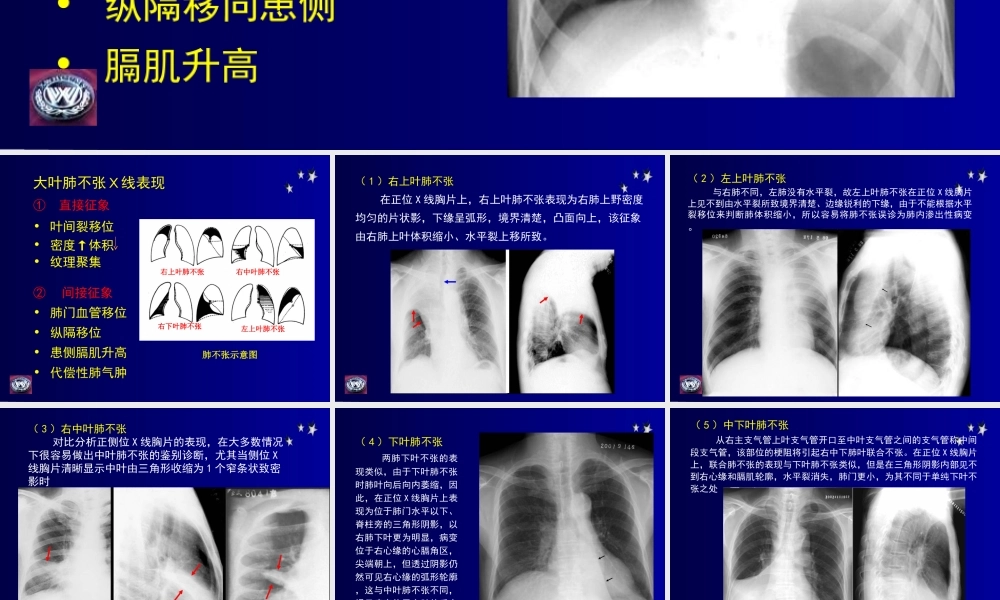 影像学-呼吸基础病变.ppt