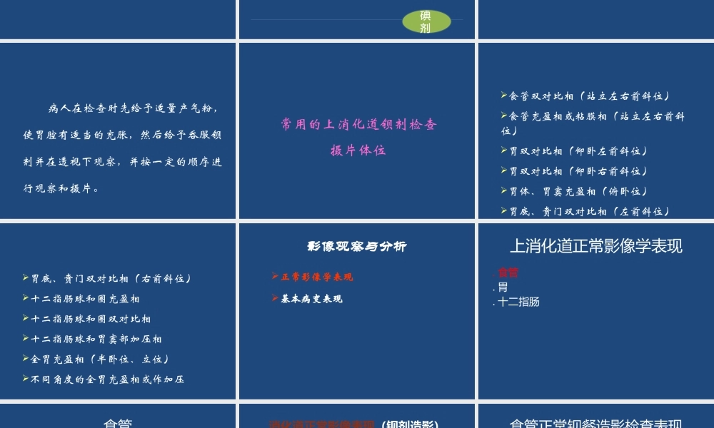 上消化道造影检查.pptx