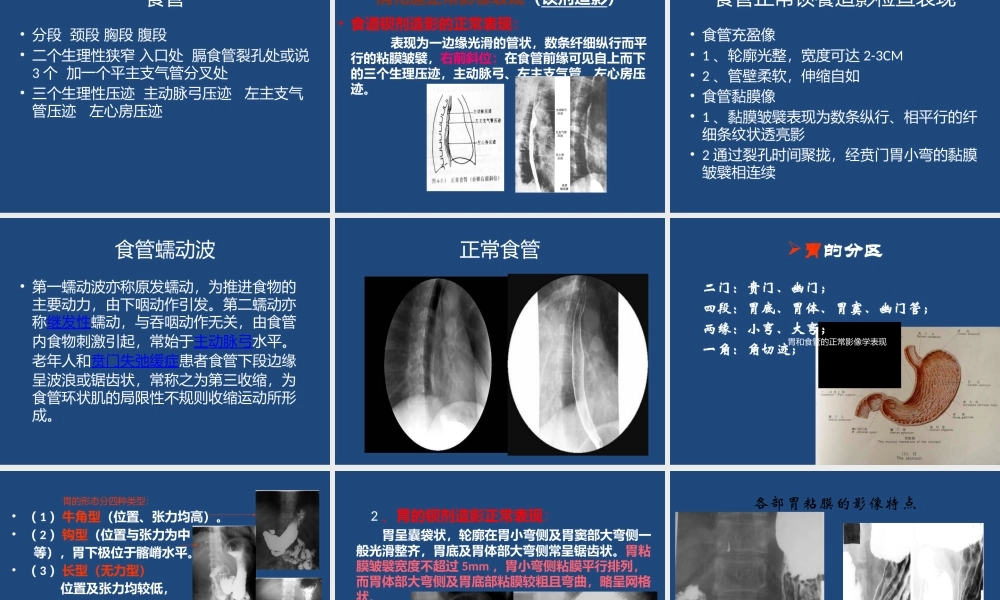 上消化道造影检查.pptx