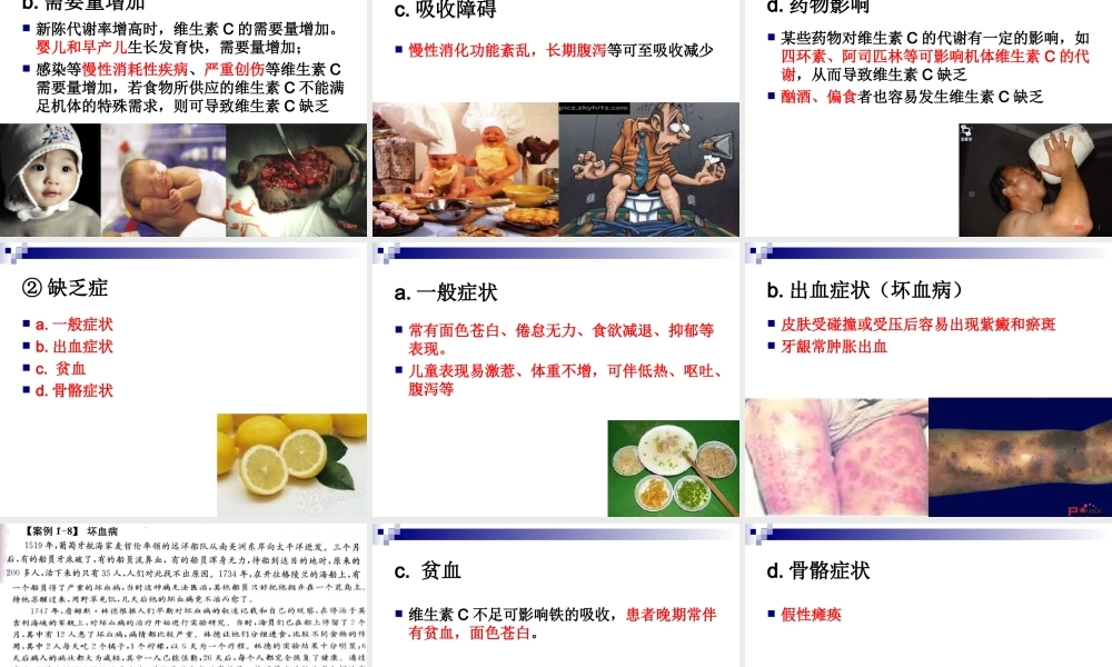 《烹饪营养学》第八讲-水溶性维生素.ppt