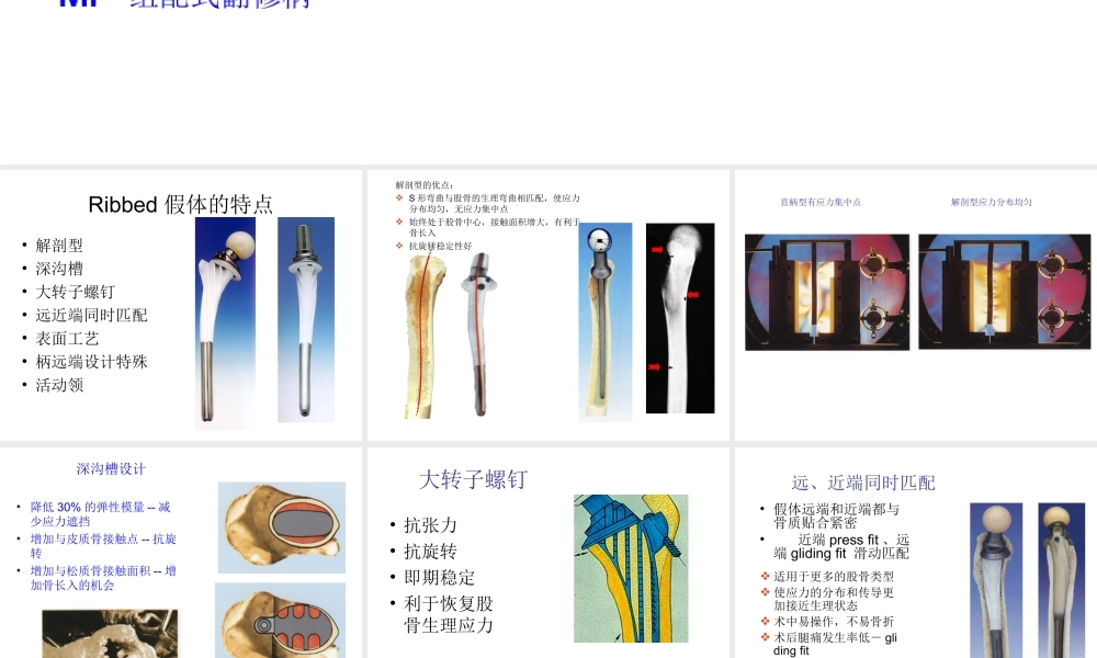 常用髋关节假体类.ppt