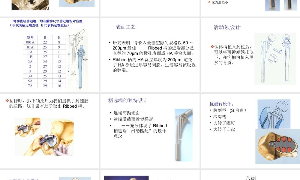 常用髋关节假体类.ppt