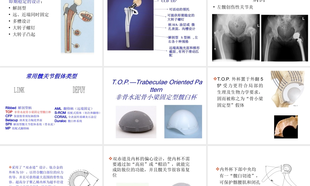 常用髋关节假体类.ppt