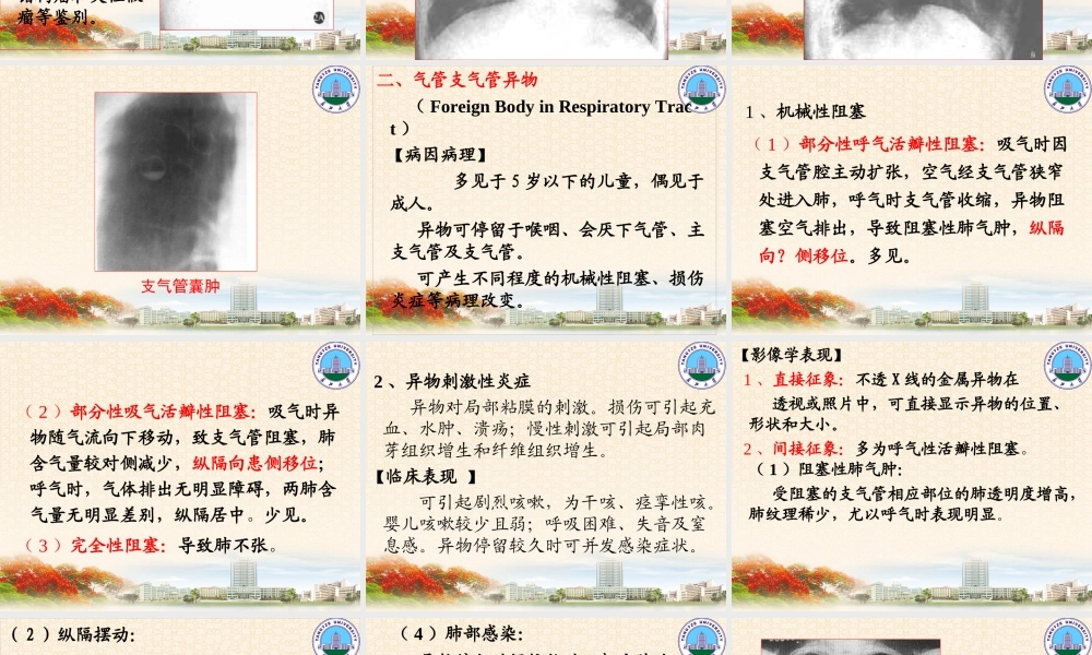 呼吸系统1(影像).ppt