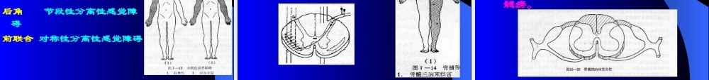 神经病学—脊髓病变.ppt