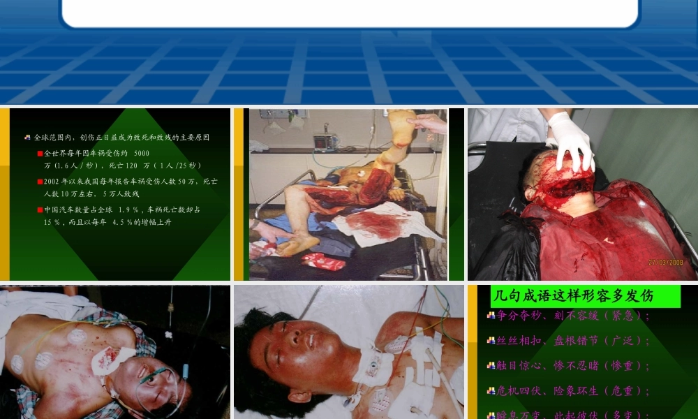 严重多发伤紧急处理.ppt