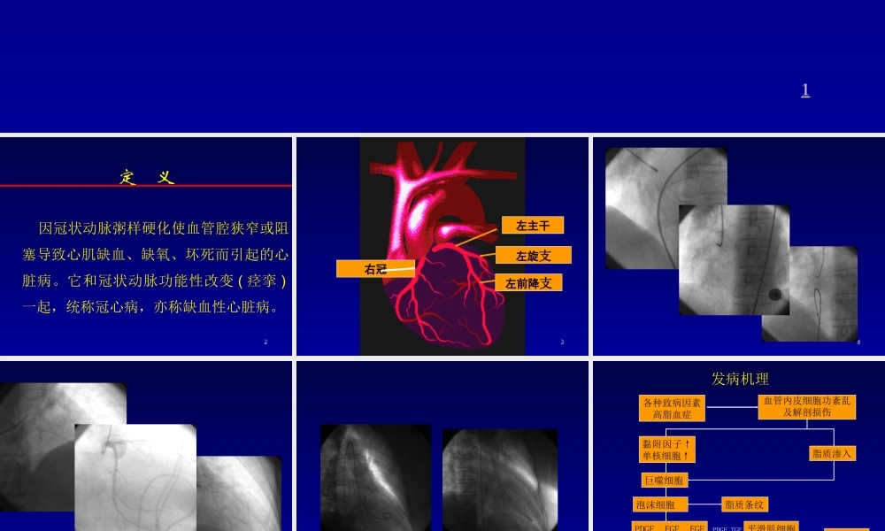 冠心病教学要PPT.ppt