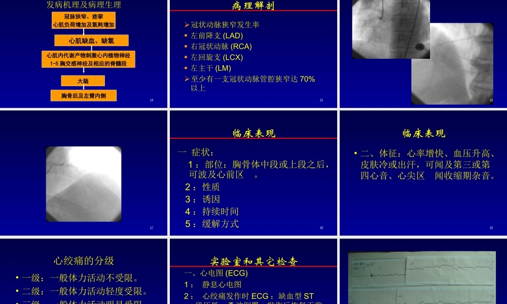 冠心病教学要PPT.ppt