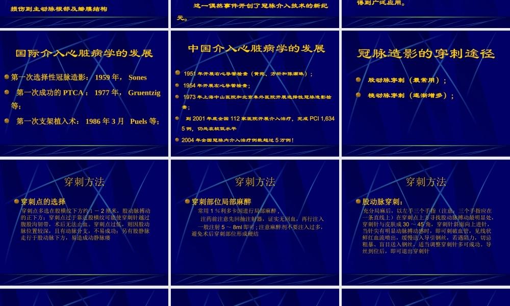 冠脉造影术一般巧.ppt