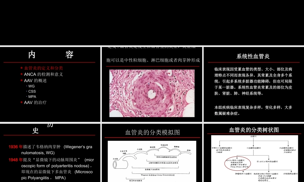 ANCA相关小血管炎.ppt
