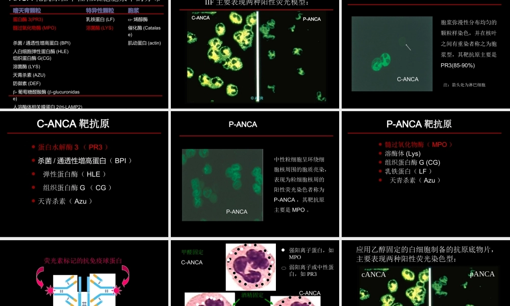 ANCA相关小血管炎.ppt