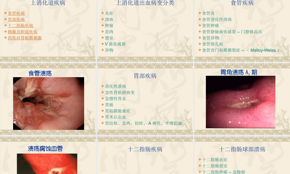 上消化道出血120汇编.ppt