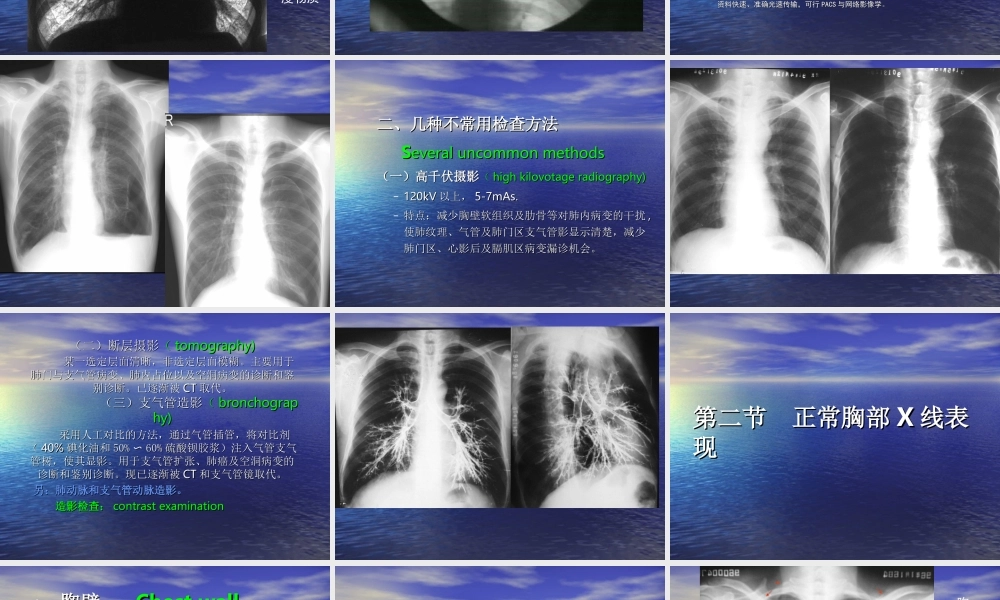 呼吸系统X线正常及异常影像.ppt