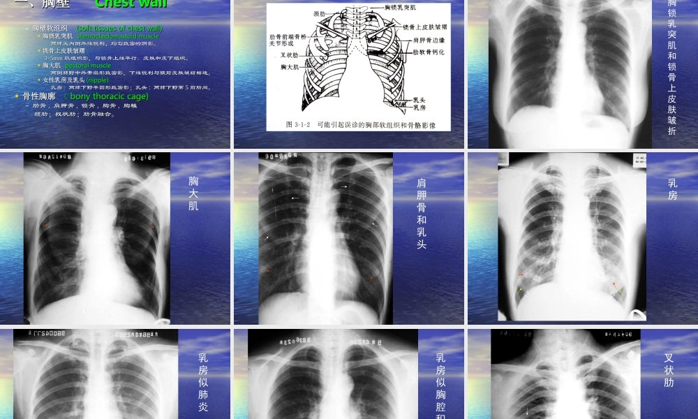 呼吸系统X线正常及异常影像.ppt