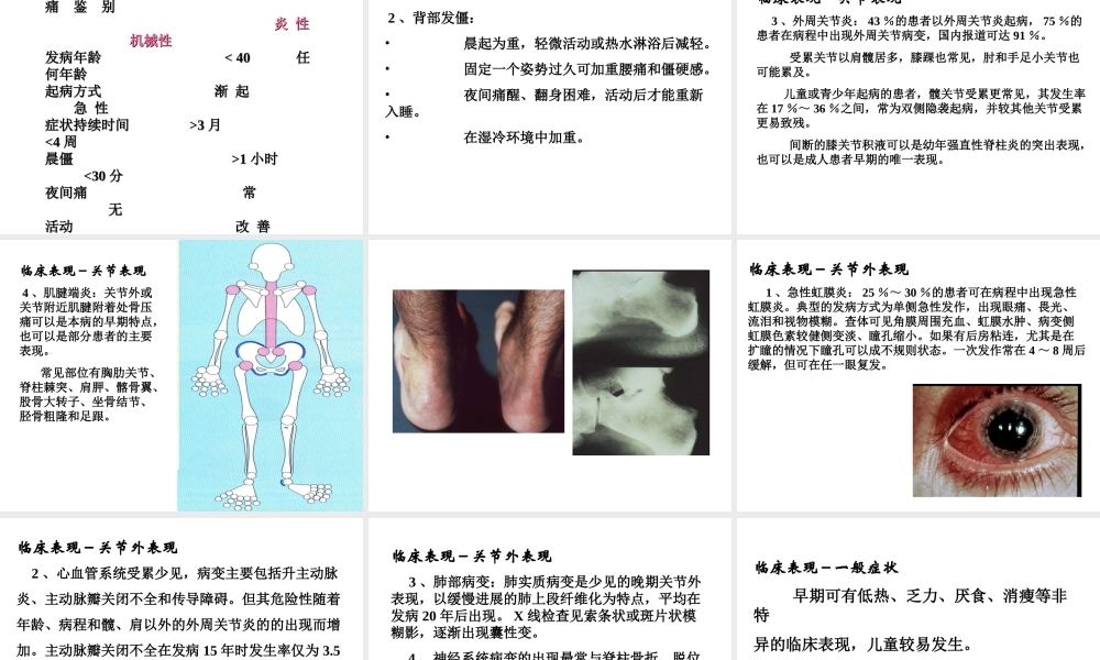 强直性脊柱炎(1).ppt