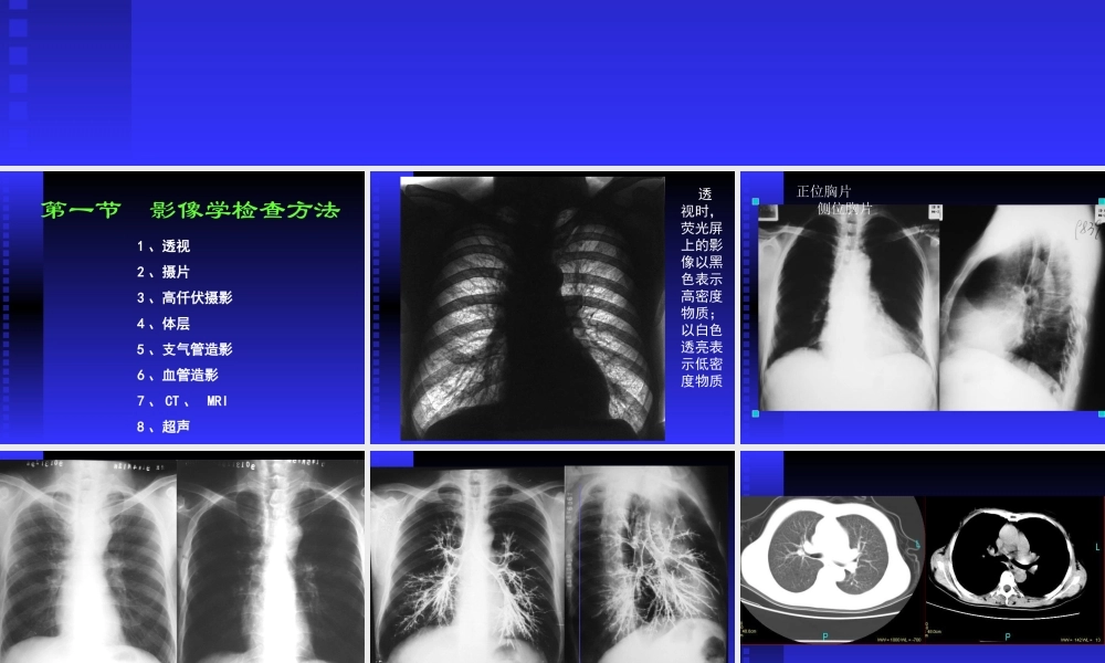 正常胸部影像学PPT.ppt