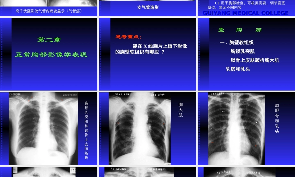 正常胸部影像学PPT.ppt