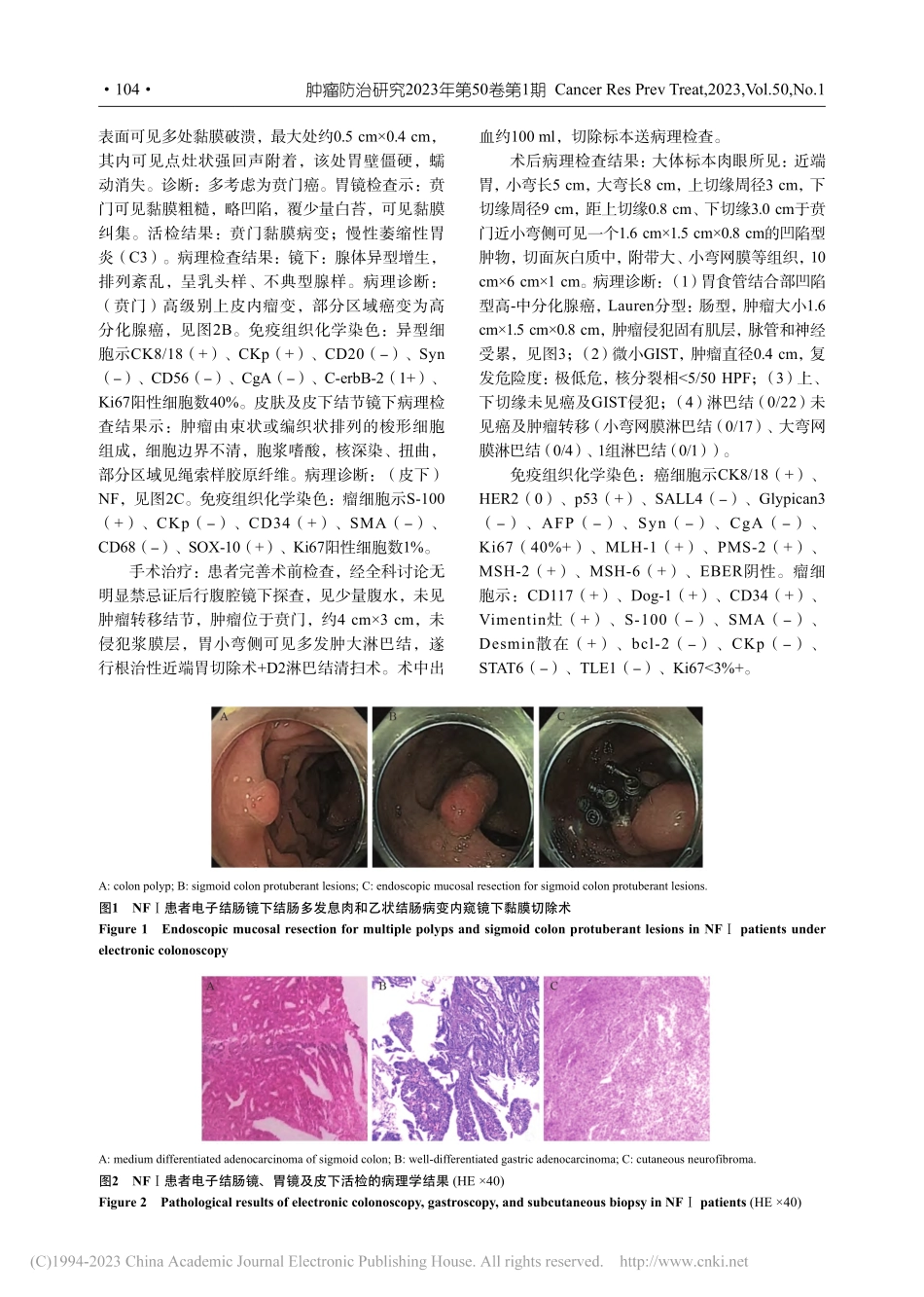 Ⅰ型神经纤维瘤合并胃癌、乙...结肠癌和胃肠间质瘤1例报道_王舟.pdf_第2页