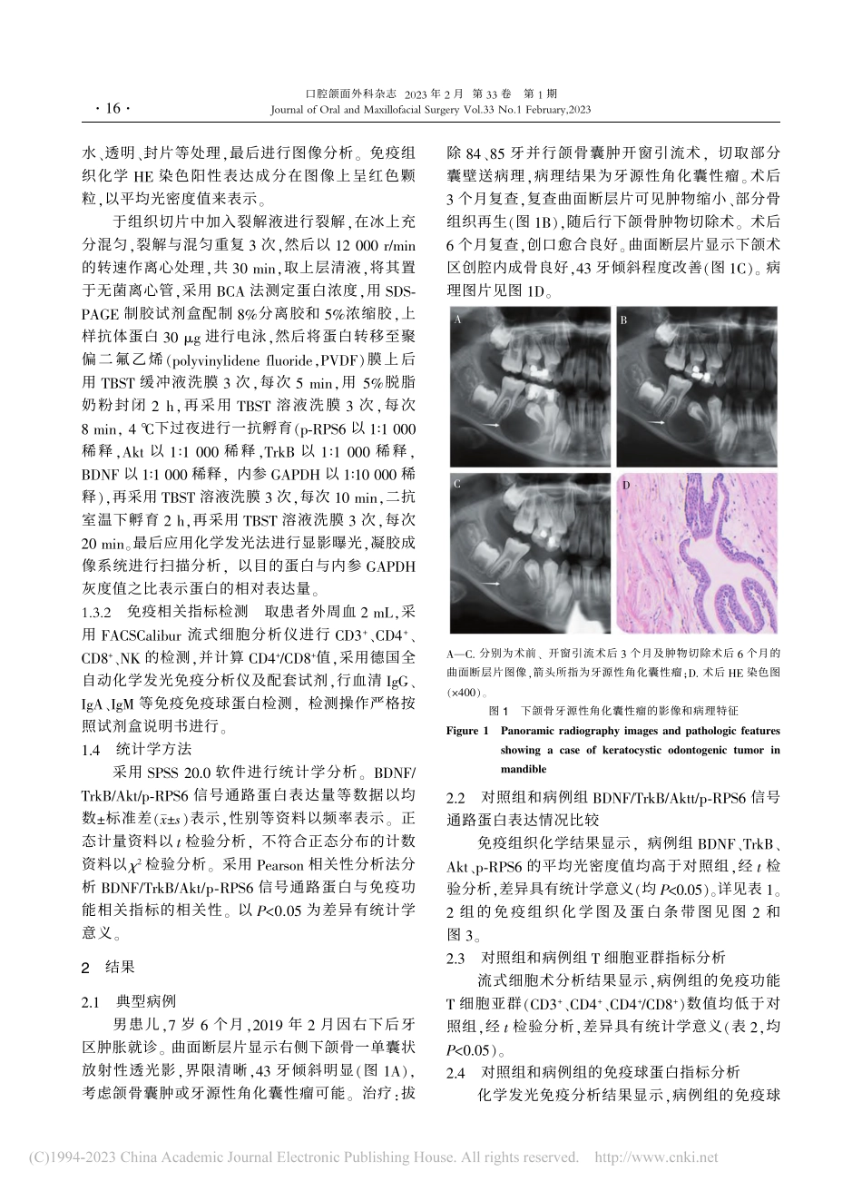 BDNF_TrkB_Akt...患儿中的作用及免疫反应分析_伍宗辉.pdf_第3页