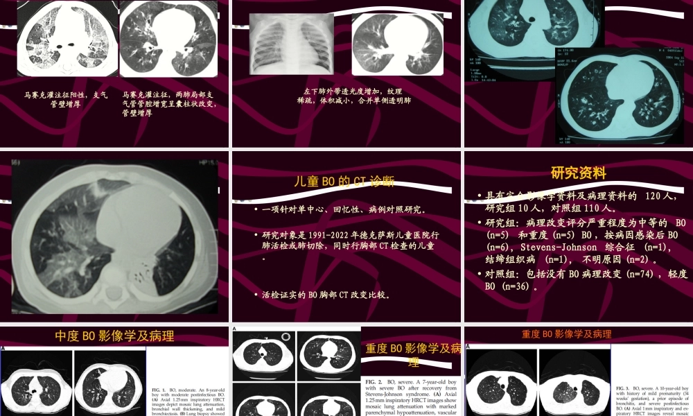 2023年闭塞性细支气管炎（教学课件）.ppt