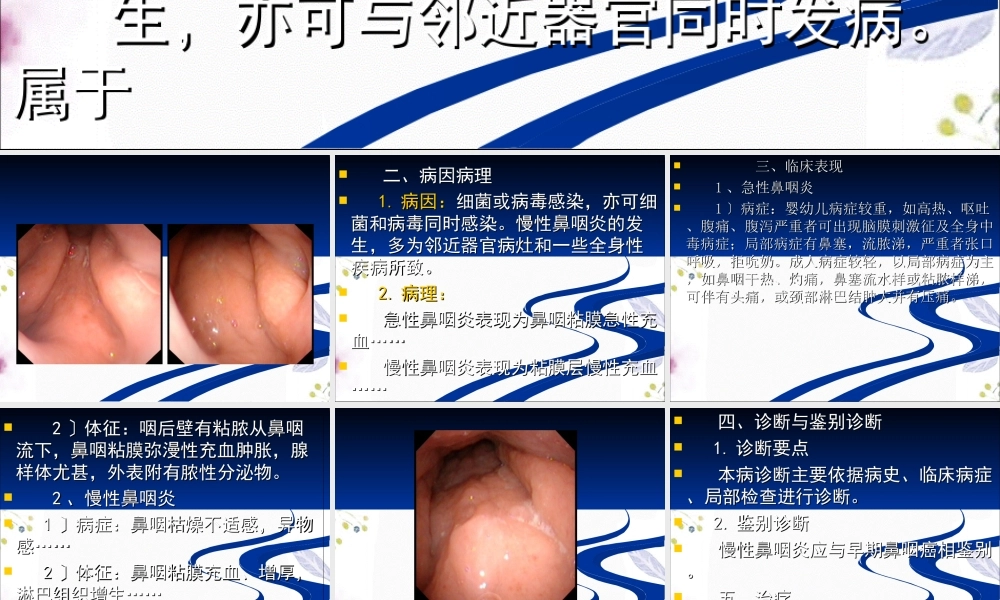 2023年鼻咽炎（教学课件）.ppt