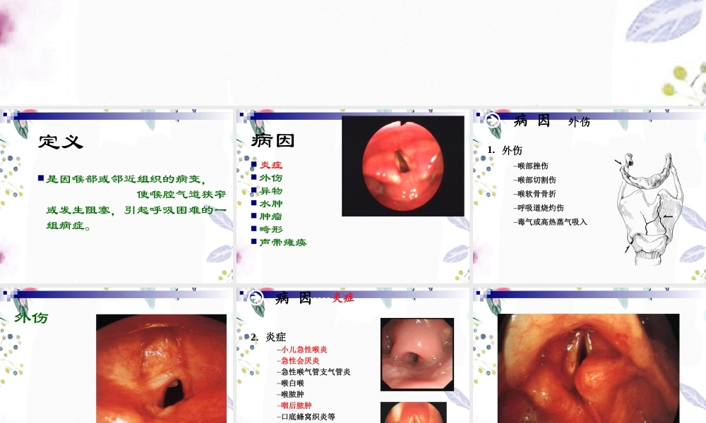 2023年喉阻塞（教学课件）.ppt