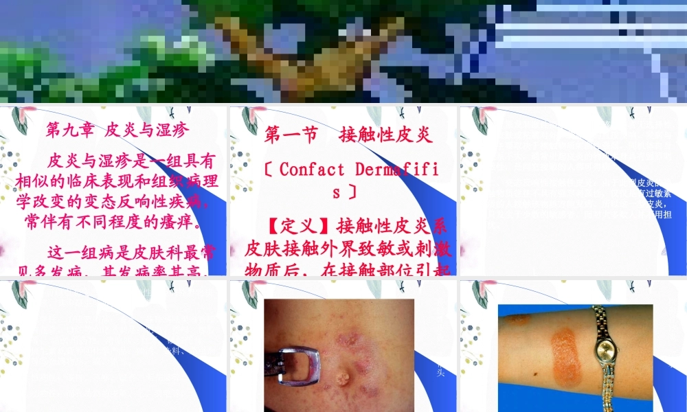 2023年皮肤性病学皮炎与湿疹（教学课件）.ppt