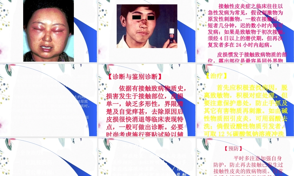 2023年皮肤性病学皮炎与湿疹（教学课件）.ppt