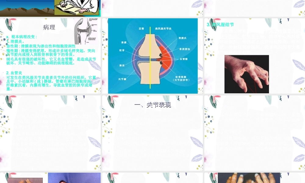 2023年类风湿性关节炎SLE（教学课件）.ppt