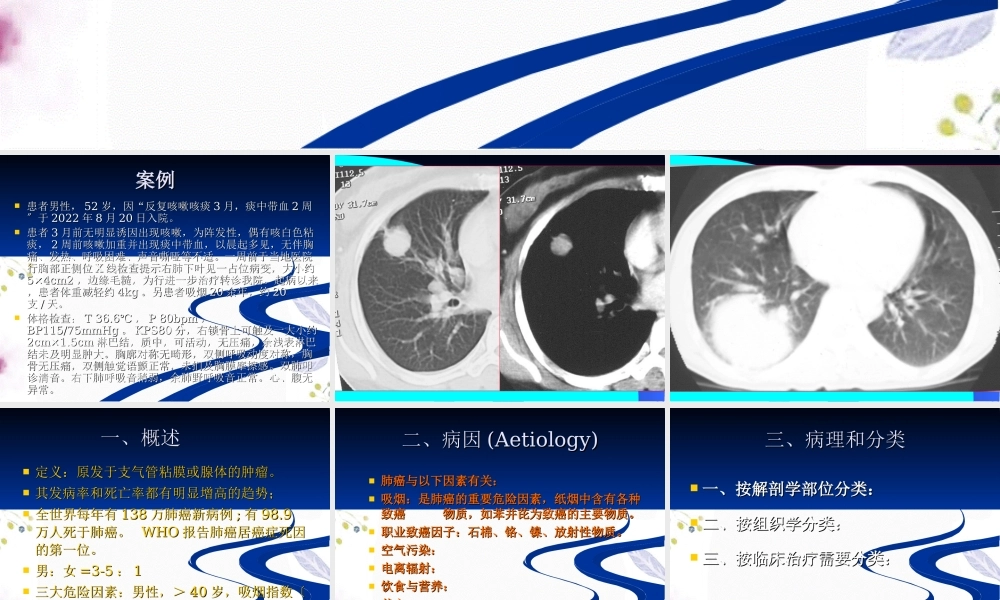 2023年肺癌（教学课件）.ppt