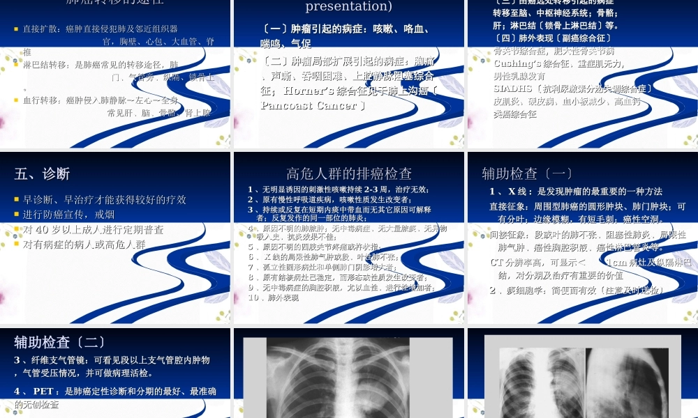 2023年肺癌（教学课件）.ppt