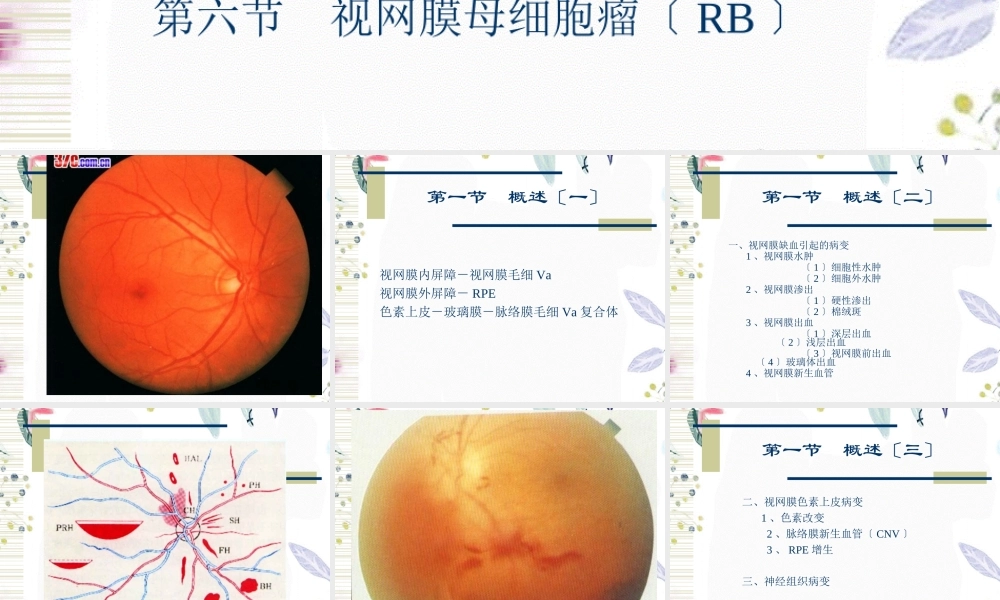 2023年视网膜病（教学课件）.ppt