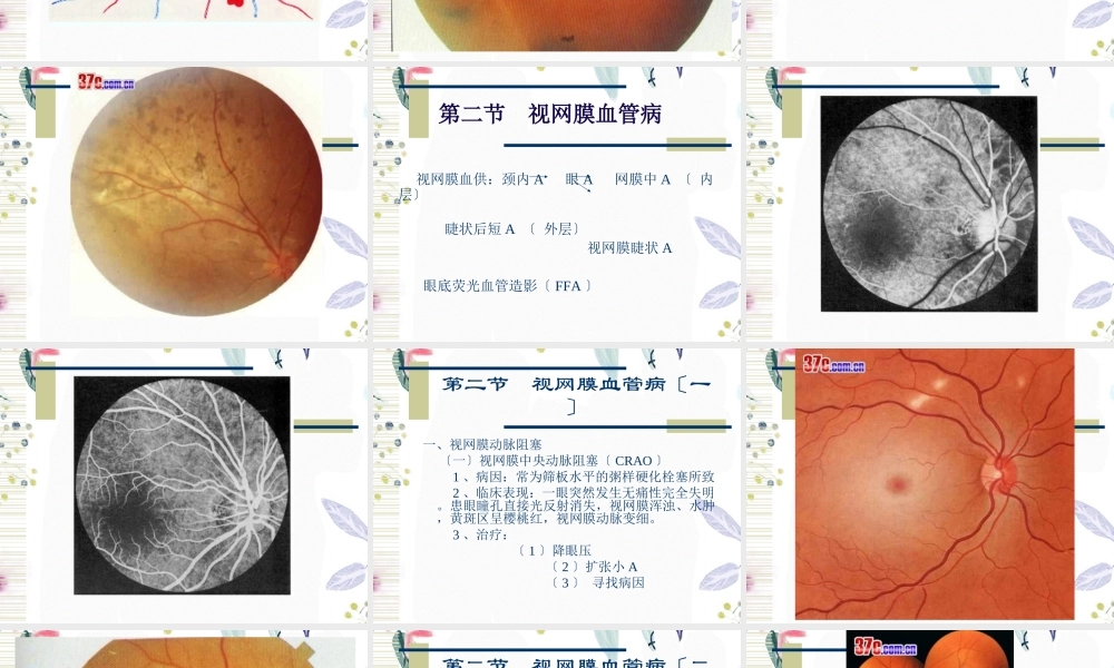 2023年视网膜病（教学课件）.ppt