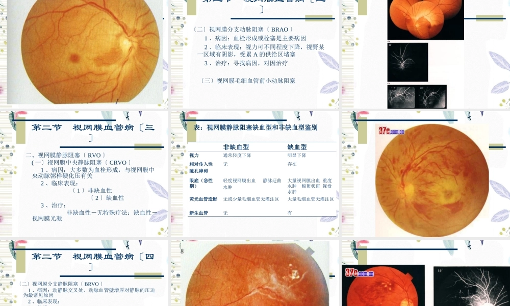 2023年视网膜病（教学课件）.ppt