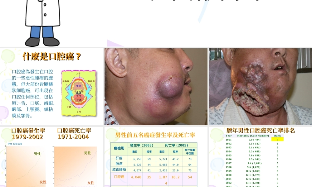 口腔癌知多少.ppt
