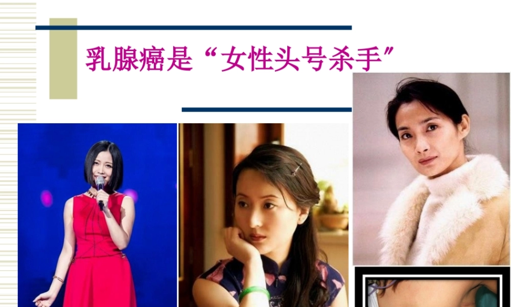 乳腺癌科普宣教ppt.pptx