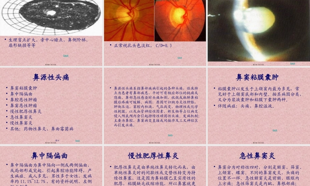 五官相关性头痛.pptx