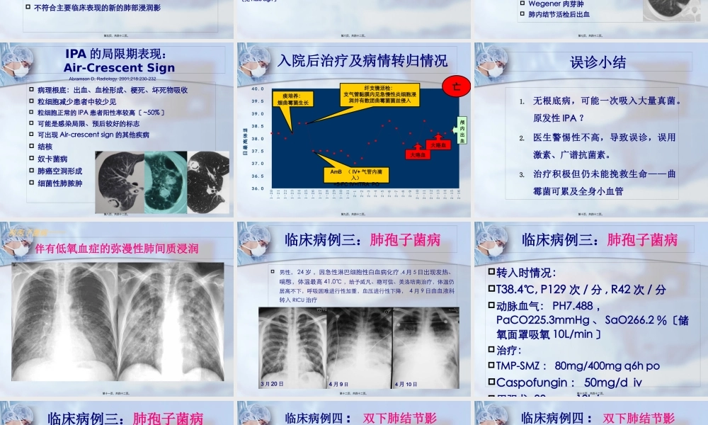 五、肺真菌(13-4-28).pptx
