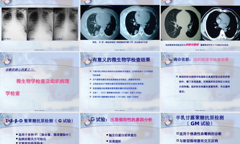 五、肺真菌(13-4-28).pptx