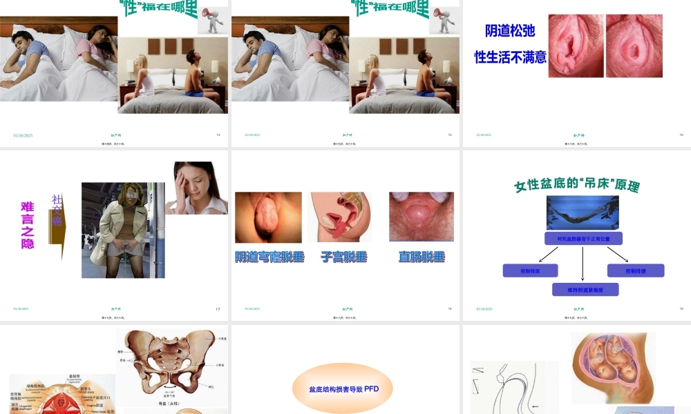 产后康复和产后运动.pptx