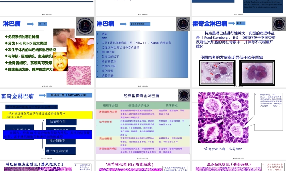 人卫三版-七八年制-淋巴瘤.pptx