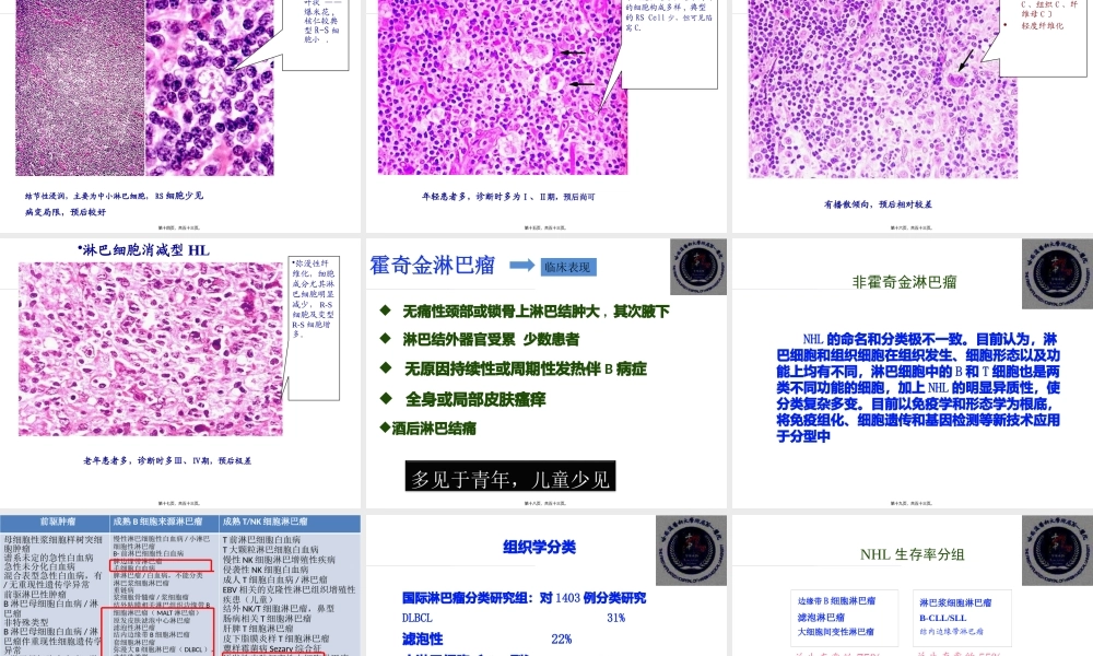 人卫三版-七八年制-淋巴瘤.pptx