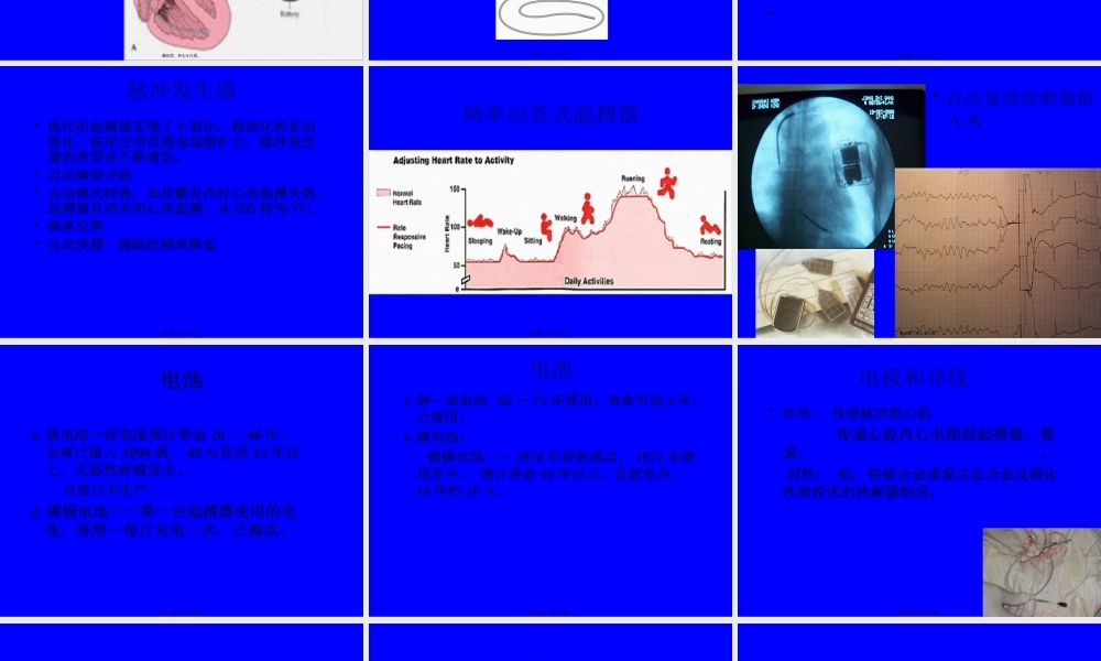 人工心脏起搏03417ppt.pptx