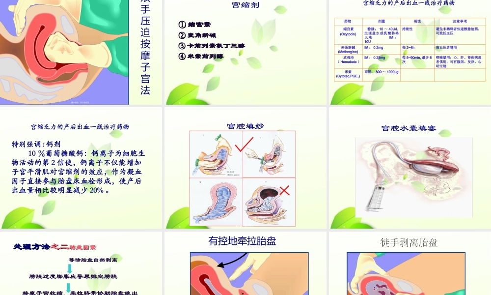 从数字看产后出血.ppt