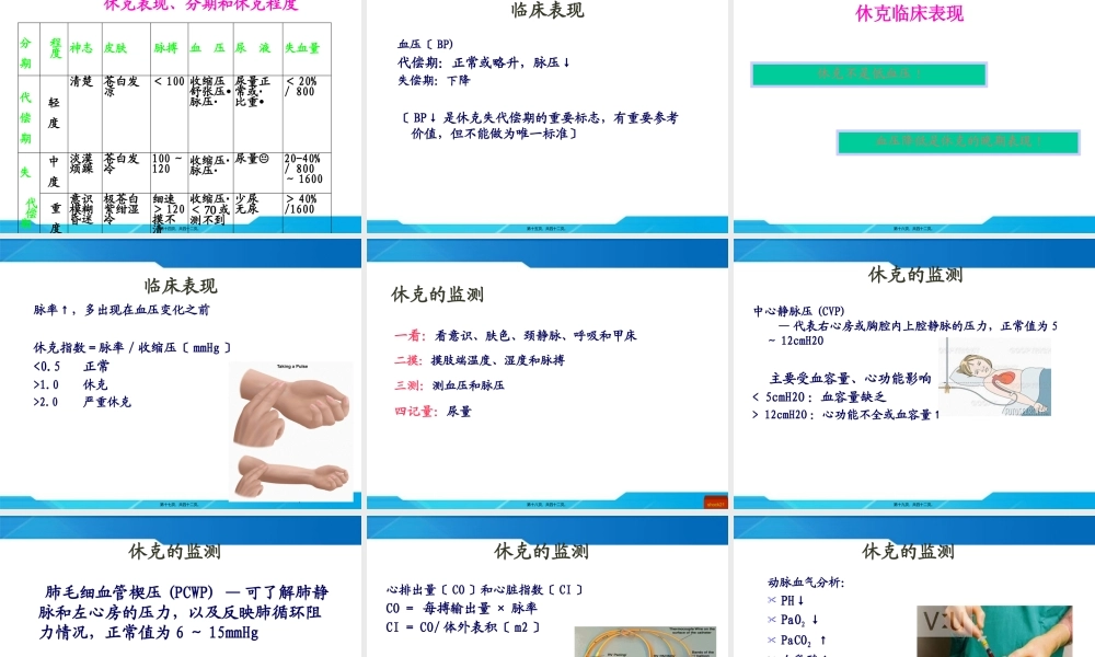 休克的急救处理.pptx