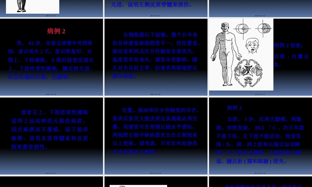 传导路病例讨论简述.pptx